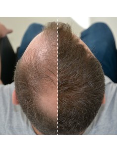 FIBRAS CAPILARES KERATINA 25 gr 2