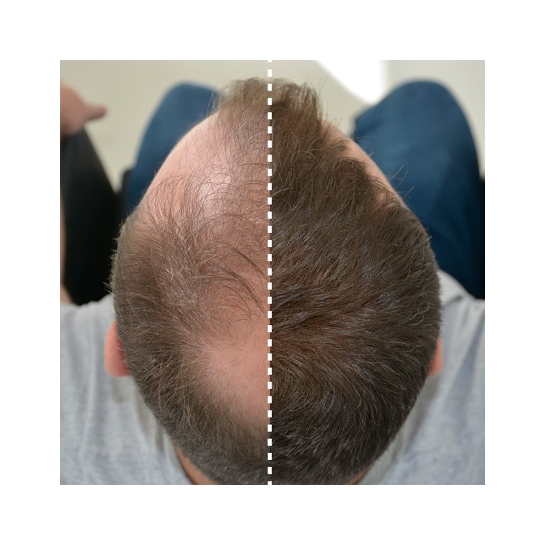 FIBRAS CAPILARES KERATINA 25 gr